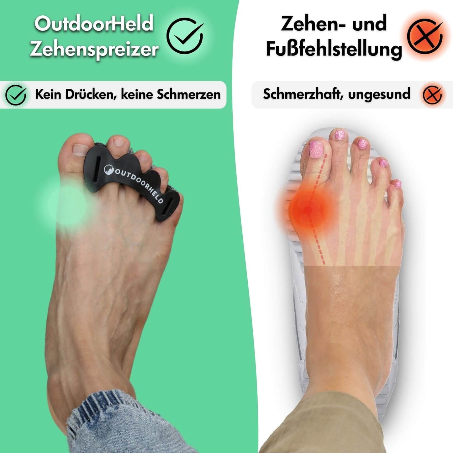 Zehenspreizer-Spar-Bundle: 2x Zehenspreizer - für alle Zehenformen geeignet
